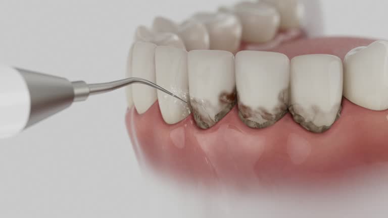Reliable Dental contractor in Fowler, CA by Smile Center Dentistry